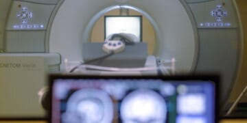 Man dies in New York after wearing chain into room with open MRI machine