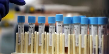Medical Journals Flooded With AI Generated 'Research' – HotAir