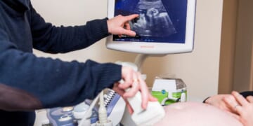 A doctor performs an ultrasound on a pregnant woman on Jan. 31, 2019.