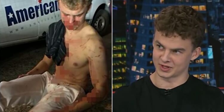 Former DOGE employee Edward "Big Balls" Coristine talked with Fox News about how he was violently assaulted in Washington D.C. in August as he went to the defense of a woman attacked by thugs.