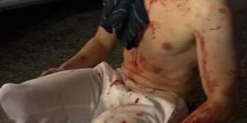 Teens Who Attacked Edward 'Big Balls' Coristine Get Rehabilitated – HotAir