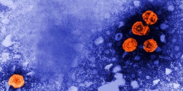 U.S. gives no-bid contract to Denmark scientists studying hepatitis B vaccine in African babies