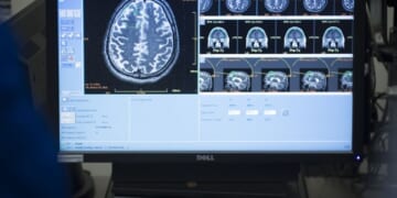 Socialized Medicine For the Win – HotAir