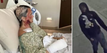 Ashley Wasielewski was attacked with a corrosive substance in Savannah, Georgia, on Dec. 10, 2025.