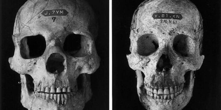 Building an Antifragile Portfolio - The Daily Reckoning