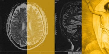 Studying Pain ‘Causes Me to Pine for Eternity’