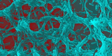 Gut bacteria may flag Parkinson’s disease risk years before symptoms appear